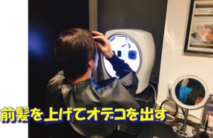 ニキビ跡 シミ
