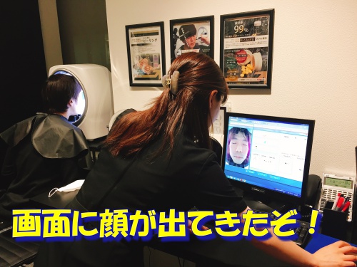 ニキビ跡 肌診断