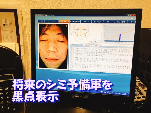 男性 スキンケアチェック