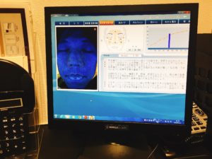 男性 スキンケアチェック