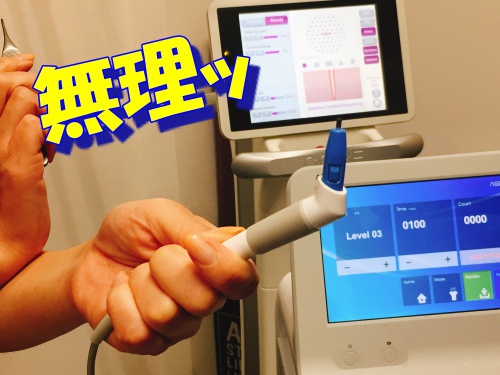 男 ニキビ治療